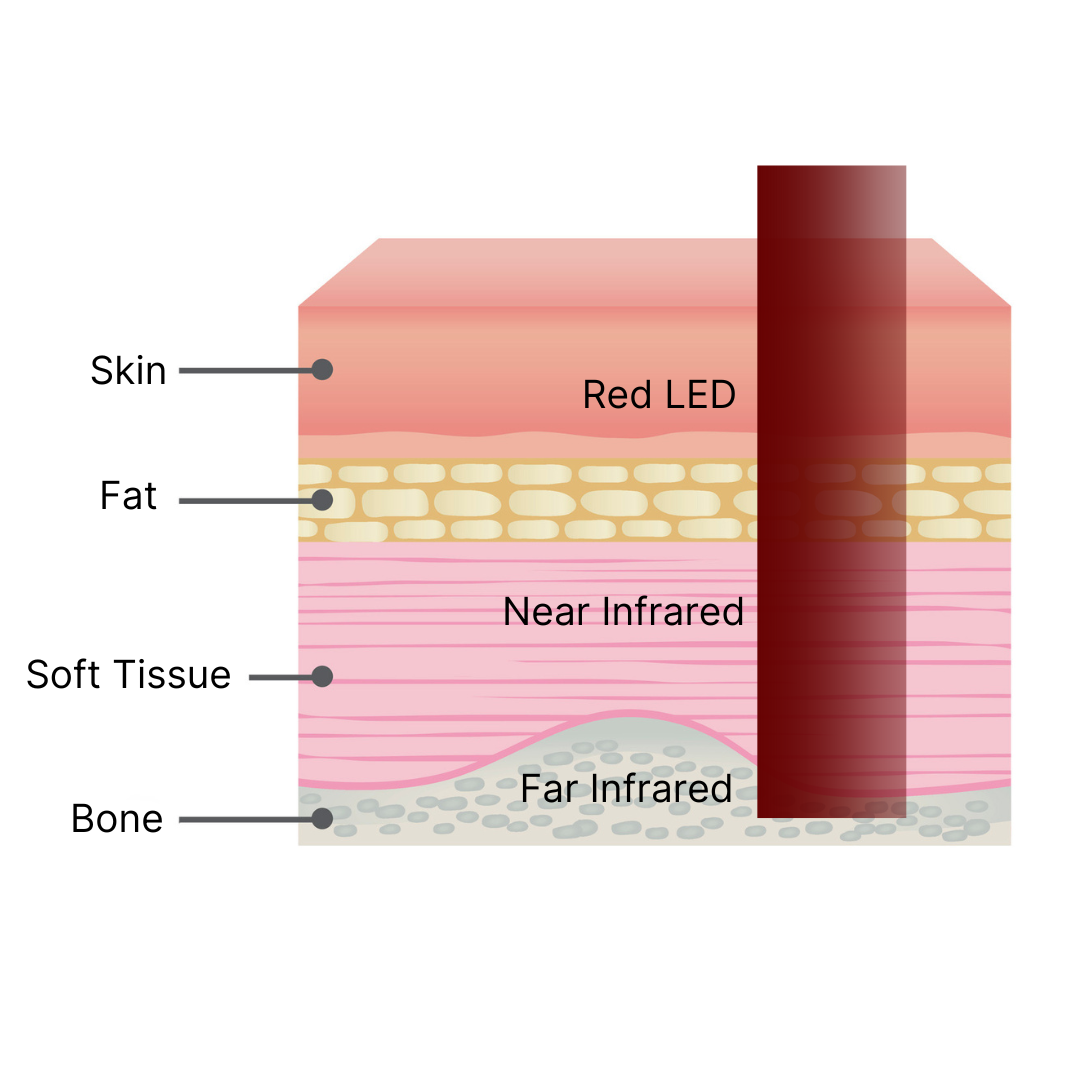 red light therapy for skin conditions